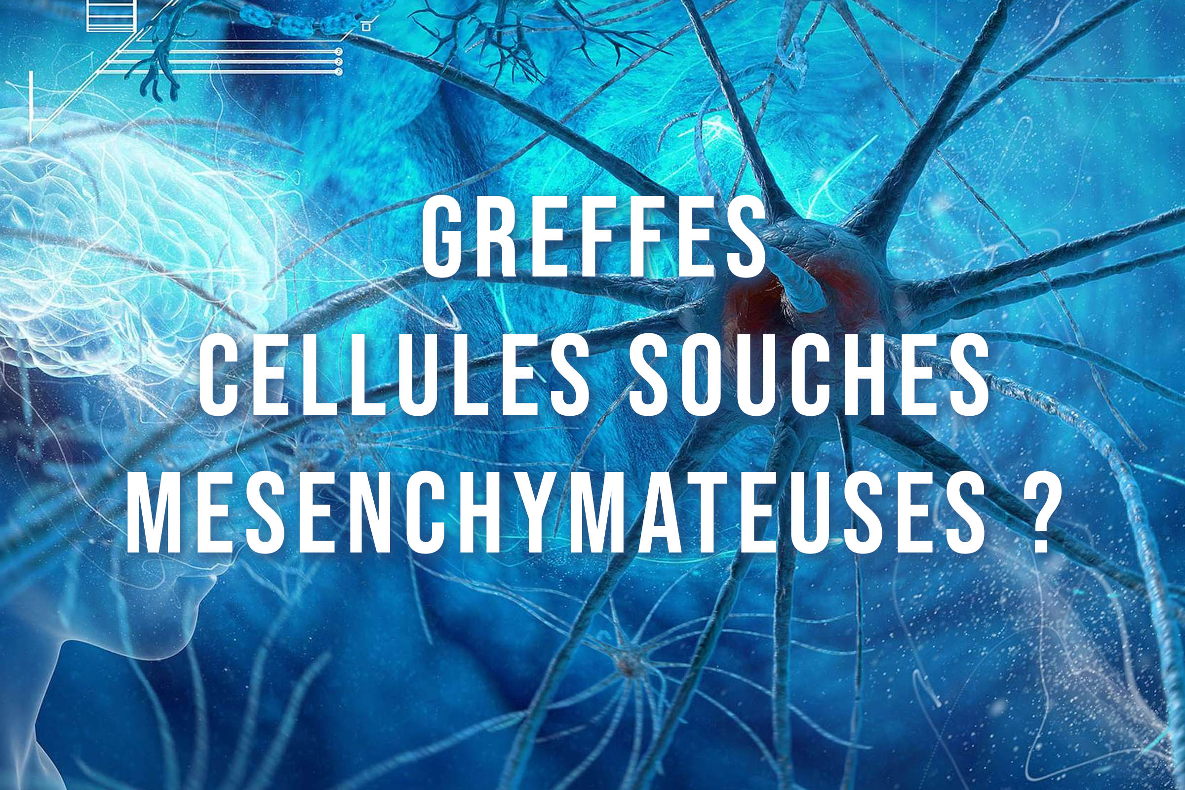 Greffe cellules souches...